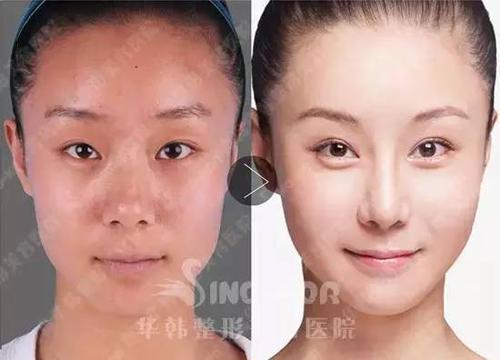 106°'四高三低 人类最美鼻形的科学密码与公认美人图鉴